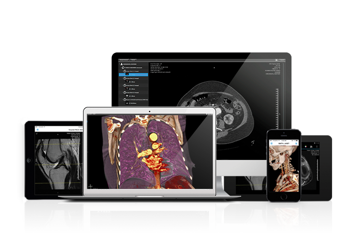 Purview zero footprint client