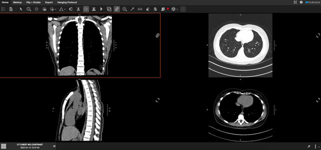 20220613 chest ct web viewer