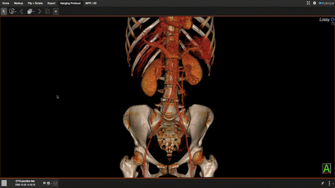 20230808 BREBIX 3D view record C