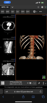 20230920 brebix 3D mobile view