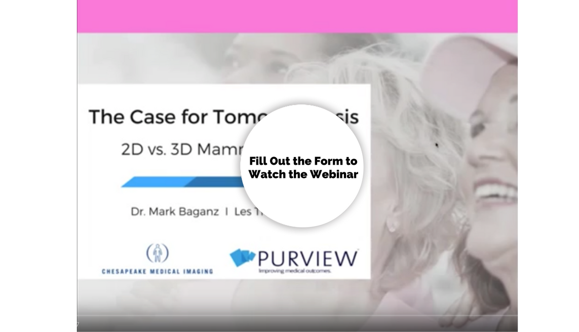 Breast tomosynthesis versus digital mammography picture
