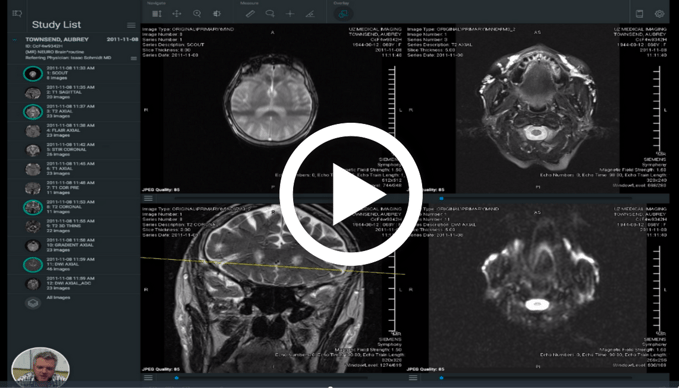 neurology-pacs