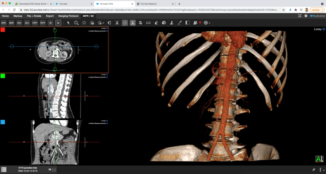 Purview Image Brebix 3D view