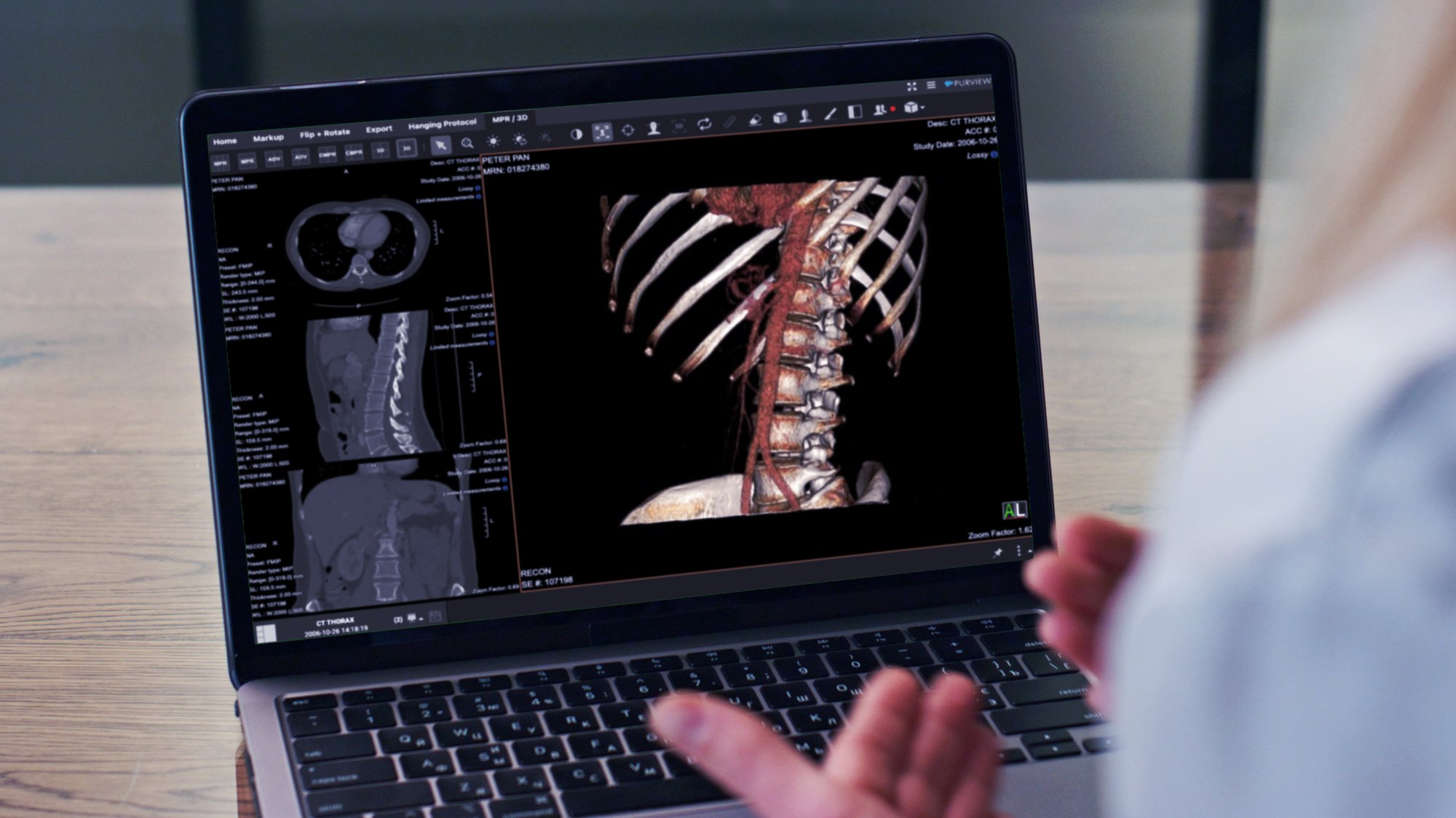 spencer-fane-user-story