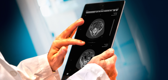 How Do I View Medical Images on My iPad or iPhone?