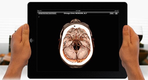 neurology-pacs