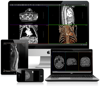Multi-Device-ViVA-Viewer-Images