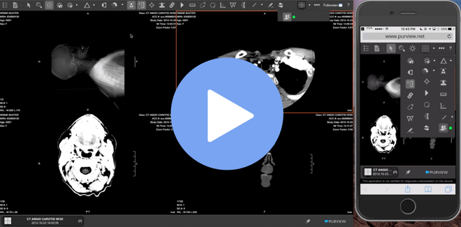 Demo for Purview ViVA, a Cloud-based PACS solution for medical imaging
