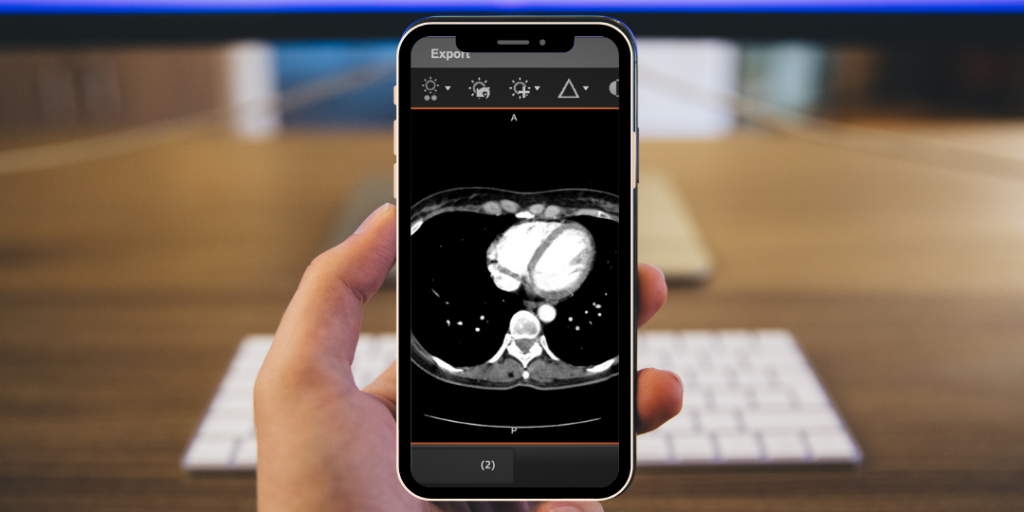 patient shares medical image with physician from cell phone 